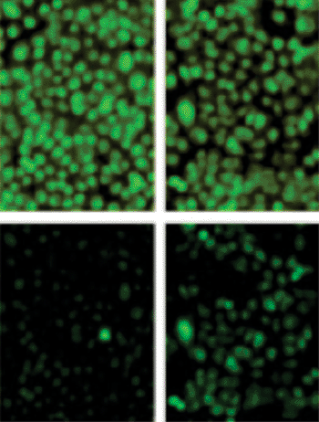 Imagen: La investigación muestra que la inhibición del DGKi reduce la actividad del ENaC, revirtiendo los efectos de la fibrosis quística. En este análisis, la luz verde se intensifica en las células con ENaC activo (abajo), por lo que los científicos examinaron los casos en donde apenas cambió la iluminación de la célula (arriba) (Fotografía cortesía del Dr. Rainer Pepperkok, del Laboratorio Europeo de Biología Molecular).